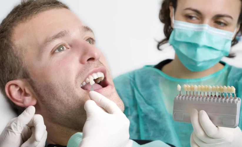 How Does Teeth Prepped for Veneers Works