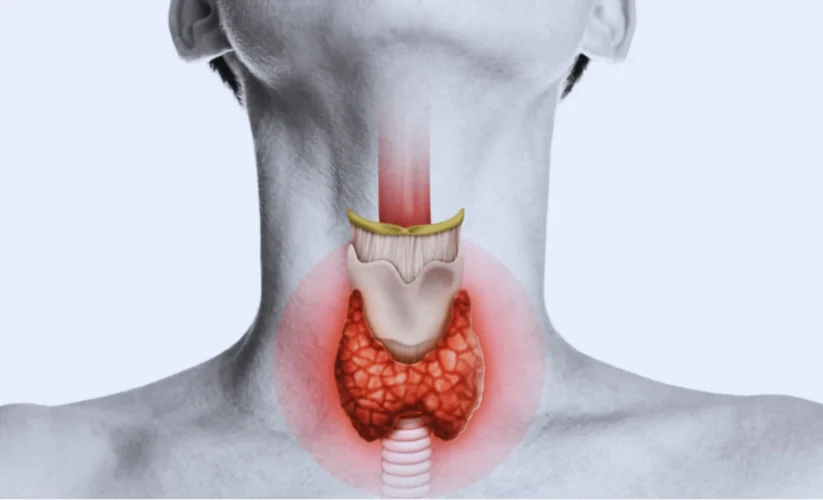 Got a Bumpy Throat? You Might Have Cobblestone