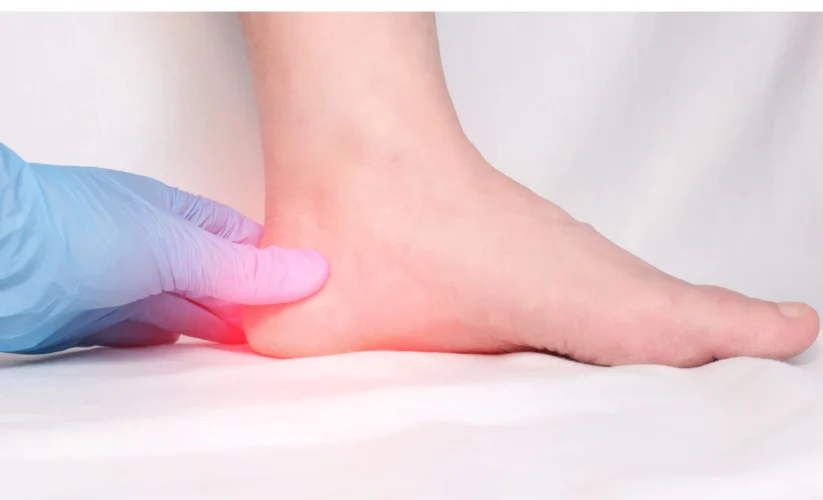 How to Cure Plantar Fasciitis in One Week