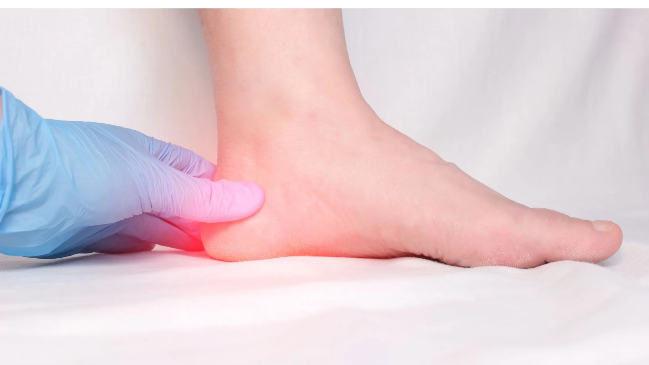 Learn How to Cure Plantar Fasciitis in One Week with expert tips