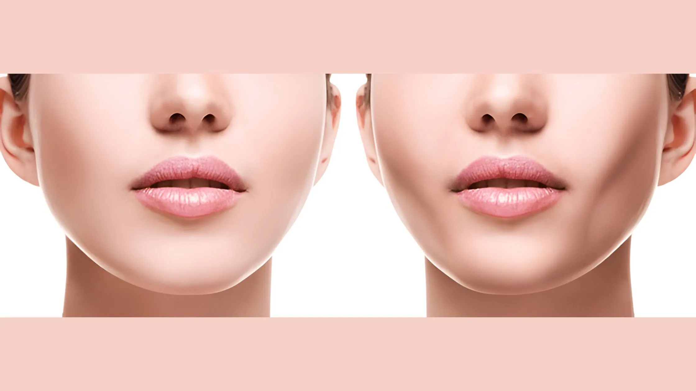 What Buccal Fat Removal Before And After Transition Offers